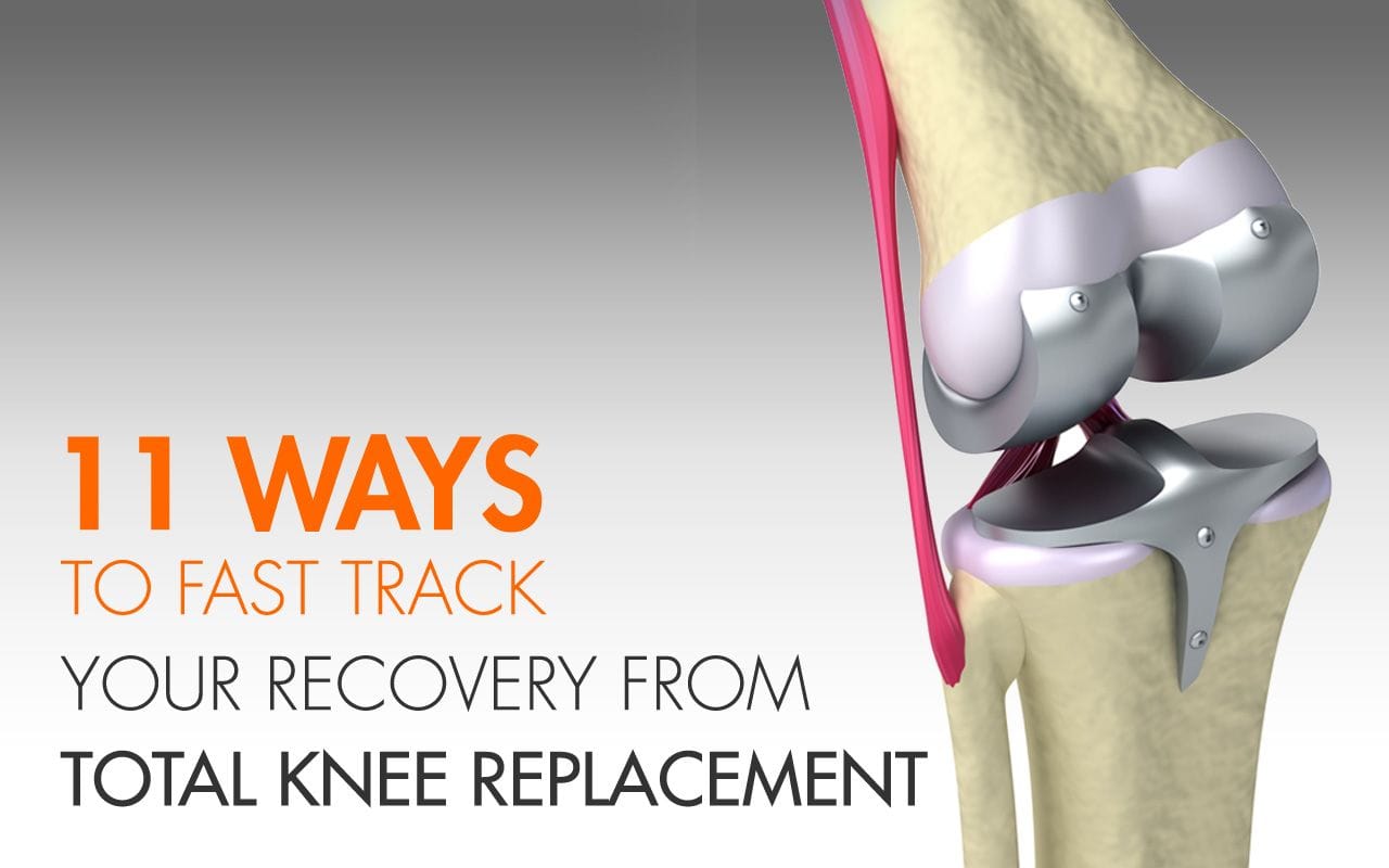 11 Fast Recovery Tips from Total Knee Replacement ...