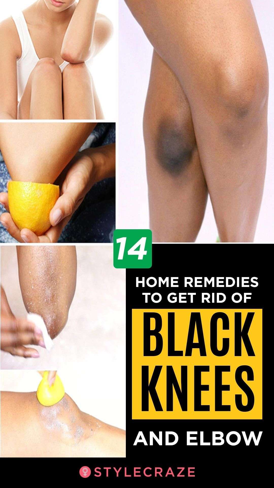14 Home Remedies To Get Rid Of Black Knees And Elbow