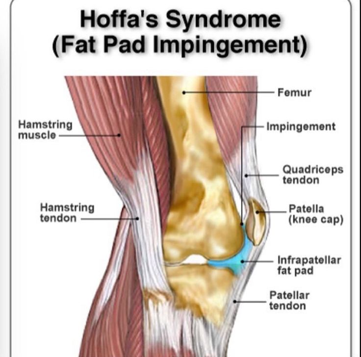 15 best Food for a Faster ACL Recovery images on Pinterest
