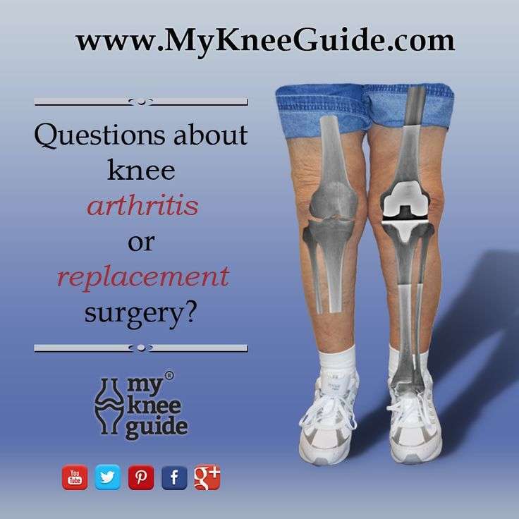 155 best Knee Replacement Surgery Information images on ...