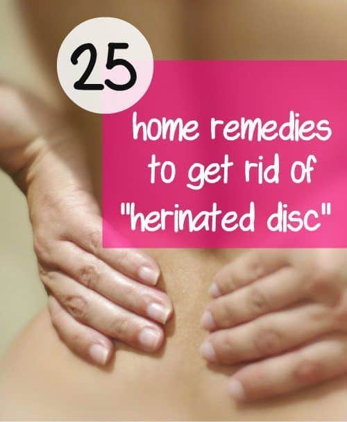 25 Home Remedies to Get Rid of Herniated Disc