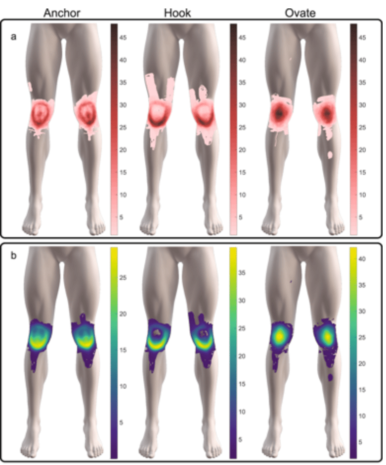 3 Patterns of Knee Pain May Help Identify the Cause