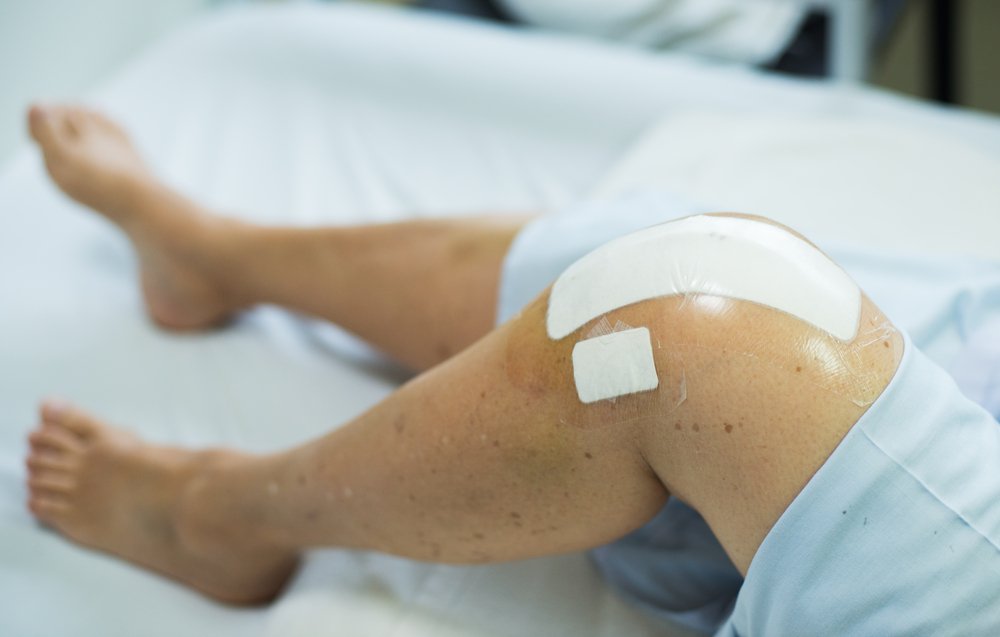 4 basics steps of a total knee replacement surgery ...