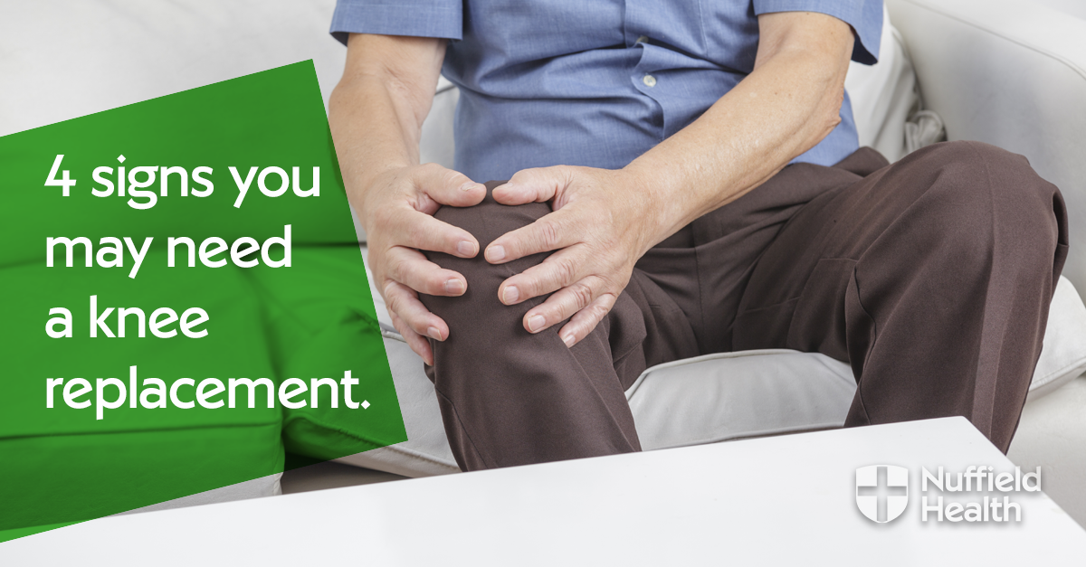 4 signs you need a knee replacement
