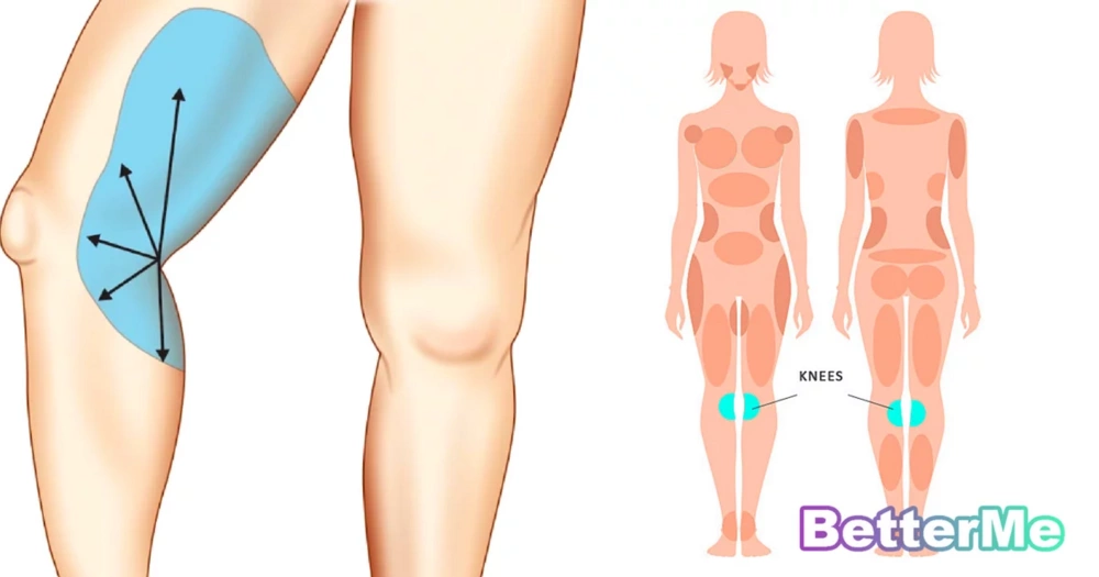 5 Best Exercises To Get Rid Of Fat On The Sides Of Your Knees