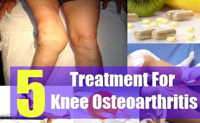 5 Best Treatment For Knee Osteoarthritis