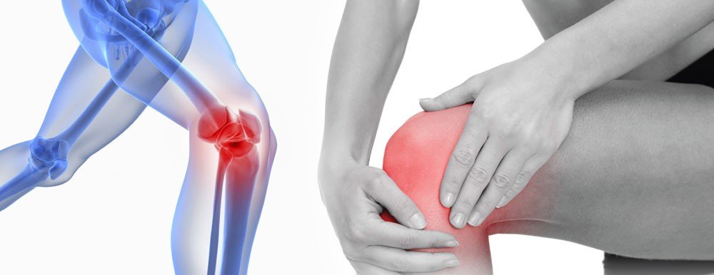 5 Things You Can Do To Reduce Knee Pain  Physio ...