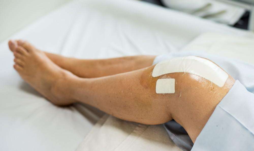 5 Tips to Speed Your Recovery After Knee Replacement Surgery: Apurva ...