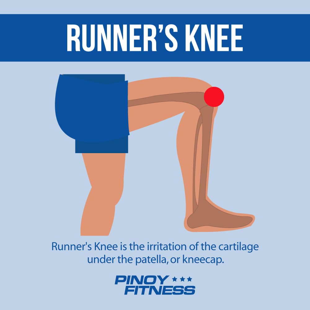 7 Common Running Injuries and What You Can Do About Them