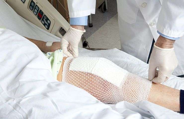 9 Things No One Ever Tells You About Getting A Knee Replacement ...