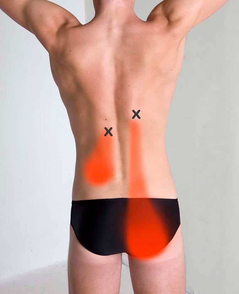 About Our Trigger Point Therapy Trigger Point Myotherapy