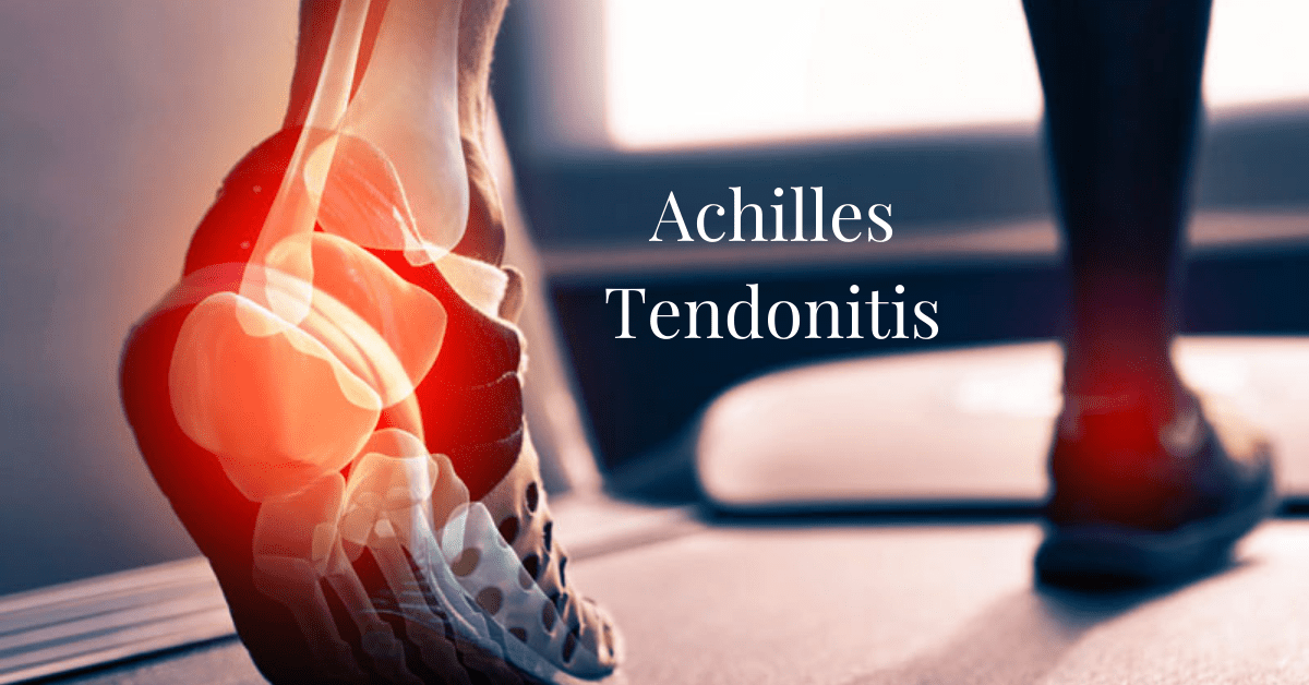 Achilles Tendonitis: Link to Knee Pain