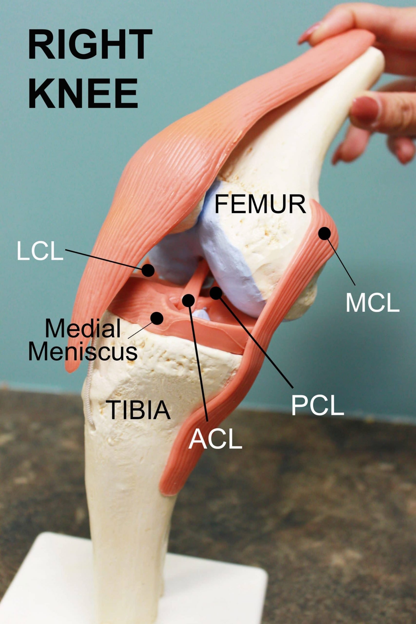 ACL Tears: To Fix or Not to Fix?