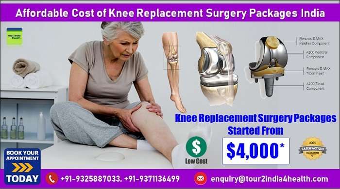 Affordable Knee Replacement Surgery For Nigerian