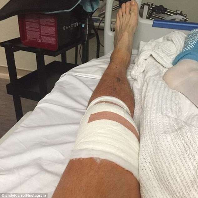 Andy Carroll reveals shocking images of injured knee after ...