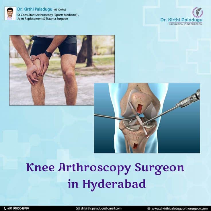 Are You Searching For Best Knee Arthroscopy Surgeon?? in 2021