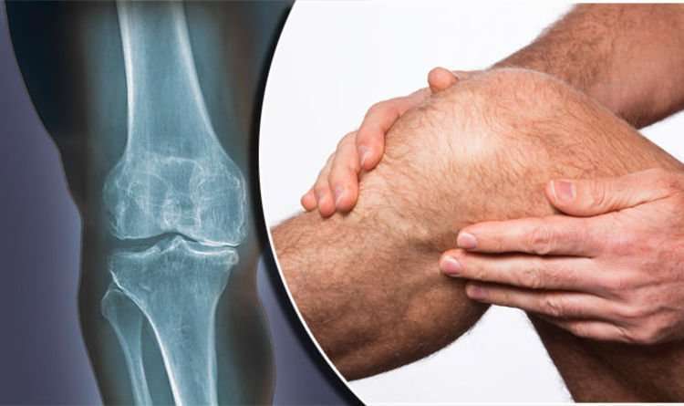 Arthritis cure? New procedure could REPAIR knee joints ...