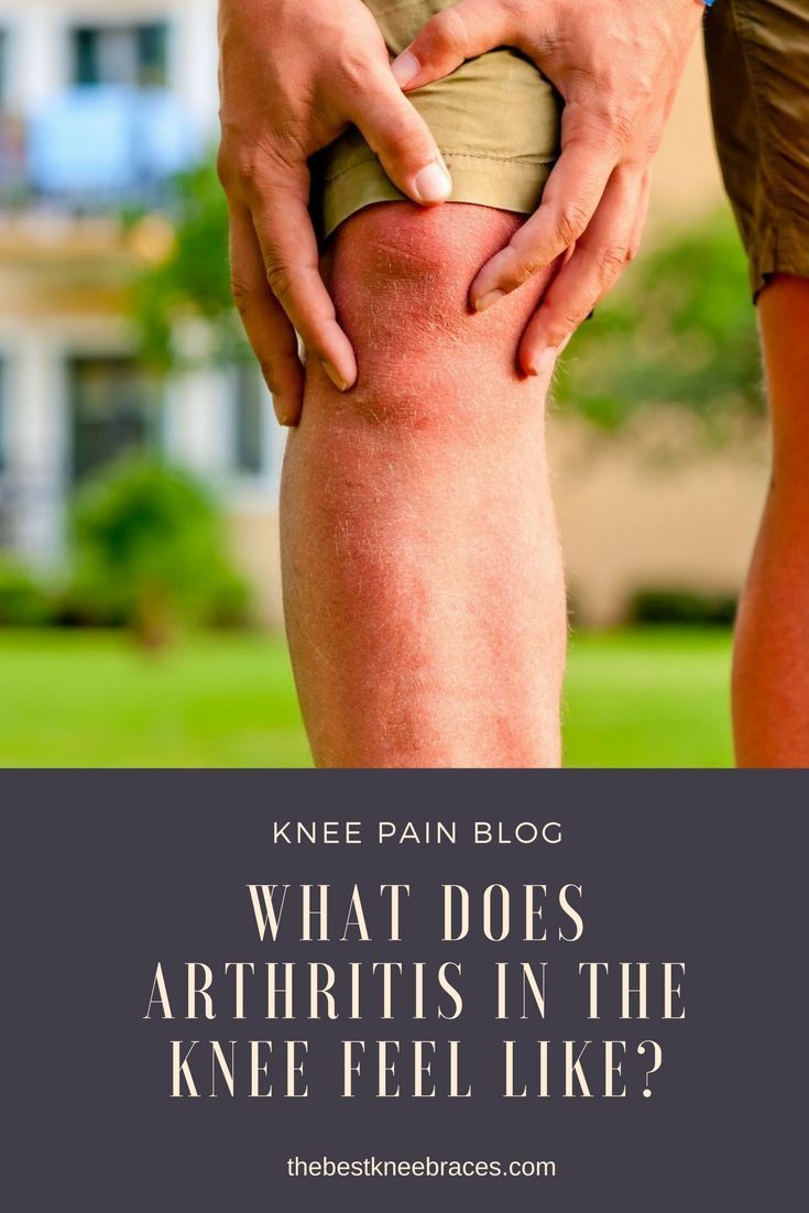 Arthritis is a very common name used to describe ...