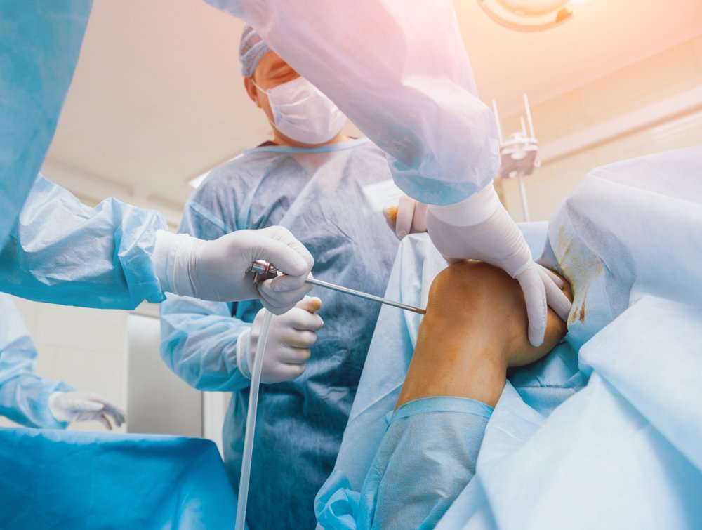 Arthroscopic Surgery for Common Sports Injuries ...