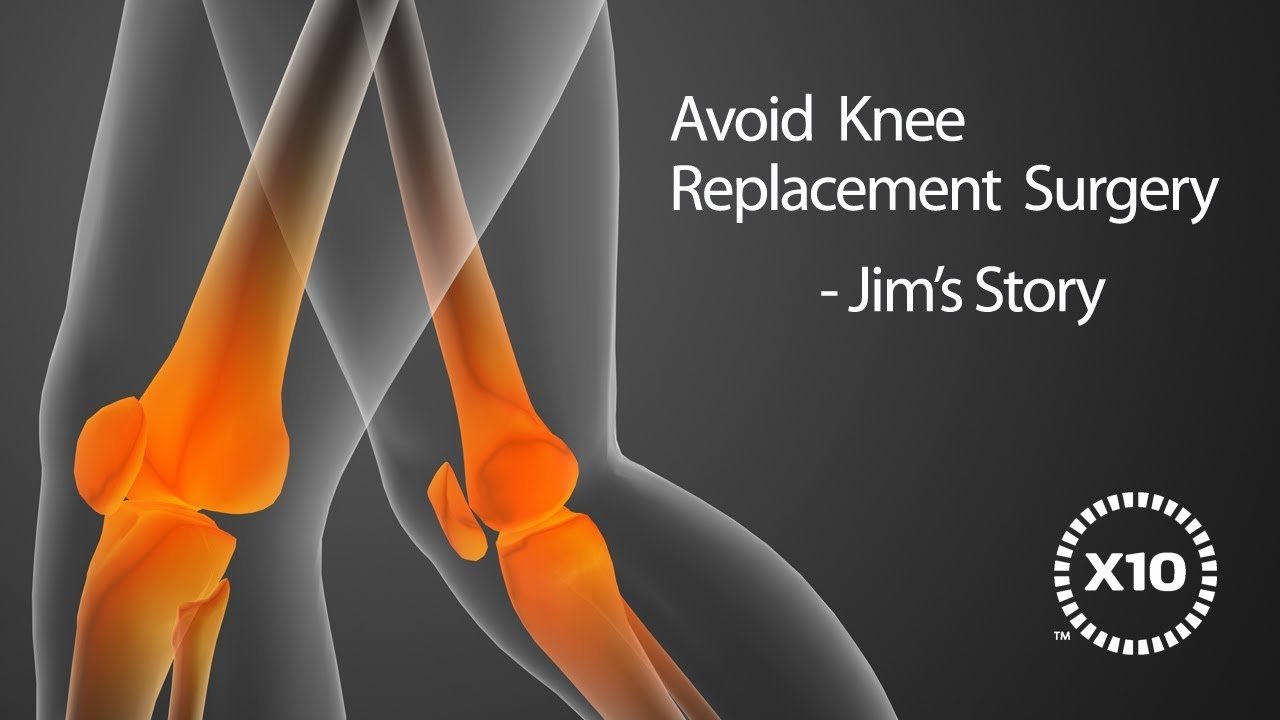 Avoid Knee Surgery