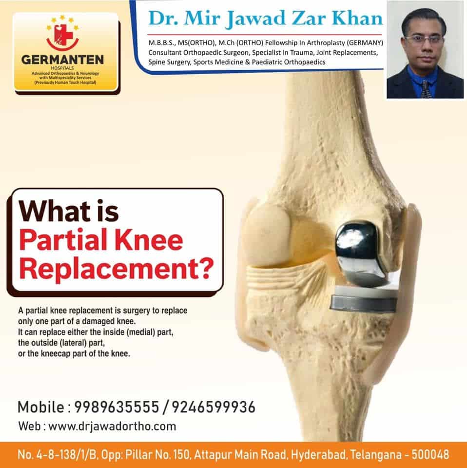Best Joint Replacement Surgeon in Hyderabad