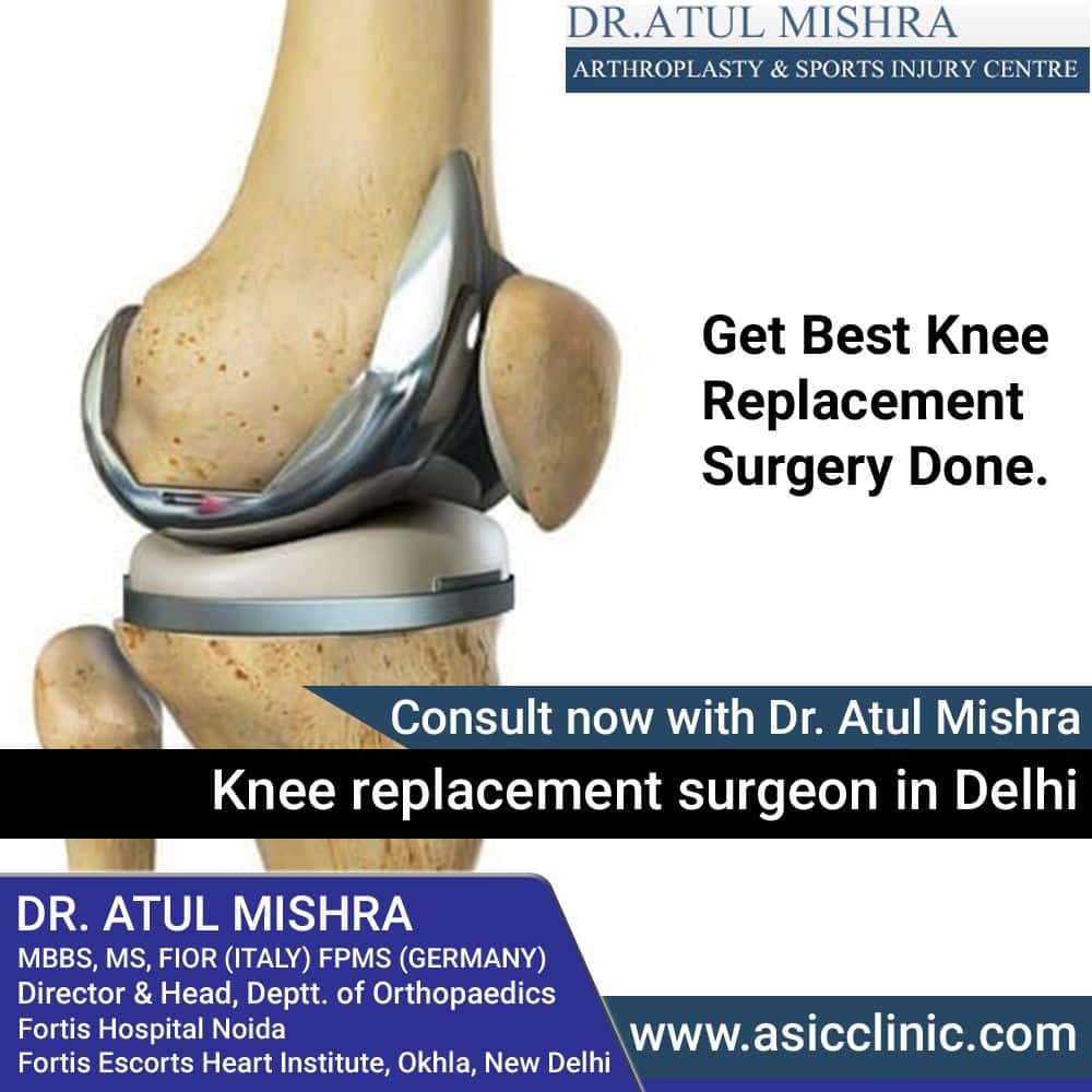 Best Knee Replacement Surgeon in Delhi NCR