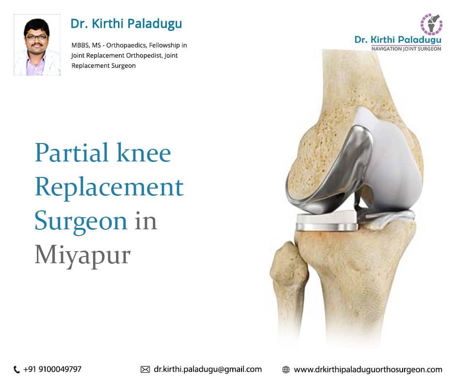 Best Knee Replacement Surgeon in Hyderabad