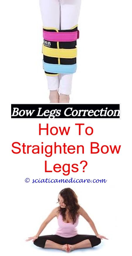 Bow Leg Correction
