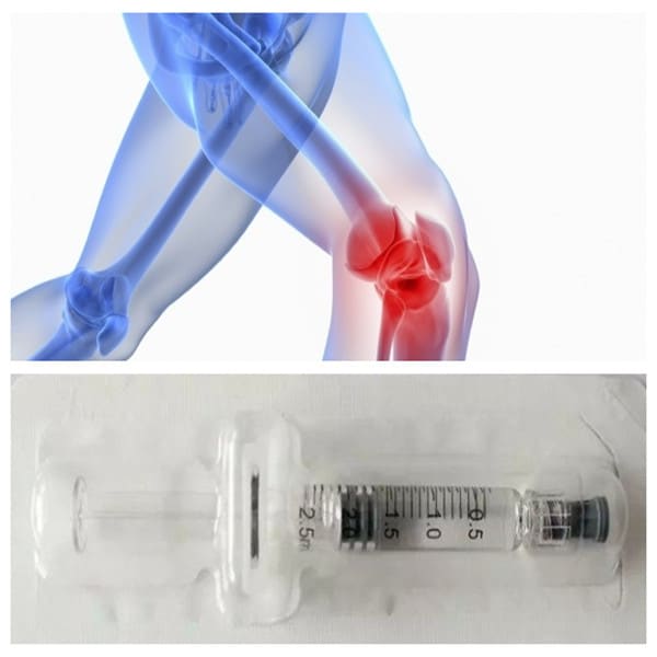 Brands Hyaluronic Acid Injectable Knee Injection 2ml