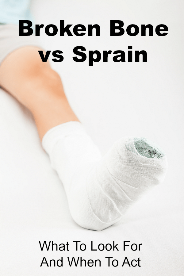 Broken Bone Vs Sprain: What To Look For And When To Act