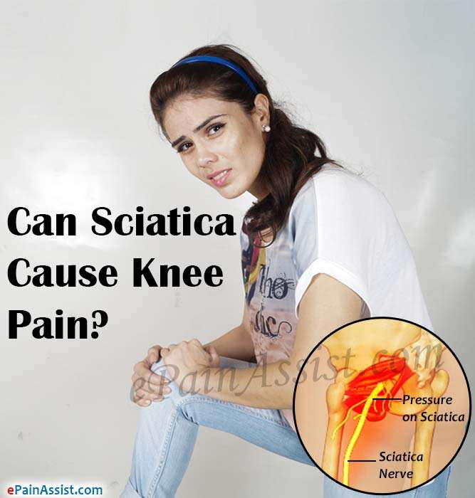 Can Sciatica Cause Knee Pain?