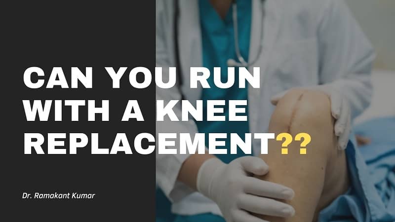 Can You Run With a Knee Replacement? [Get Answer Here]