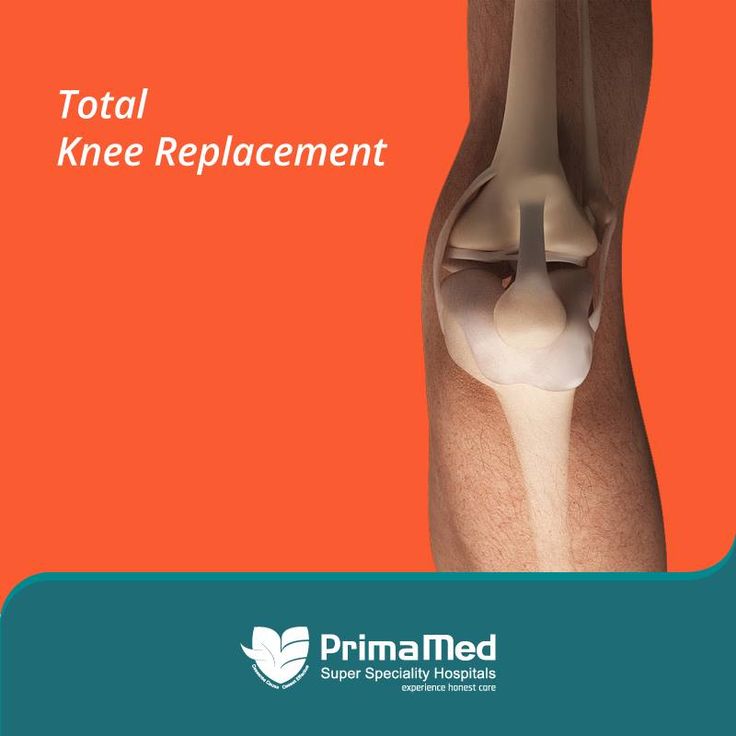 Check out our new affordable pricing for a different type of knee ...