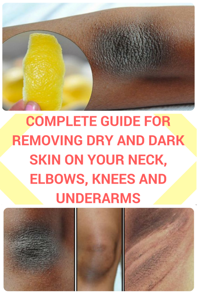 Complete Guide For Removing Dry and Dark Skin on Your Neck ...