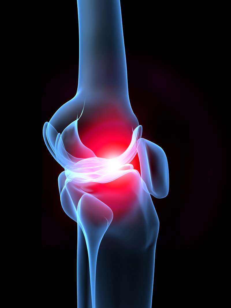 Conservative Treatment for Knee Cartilage Injuries