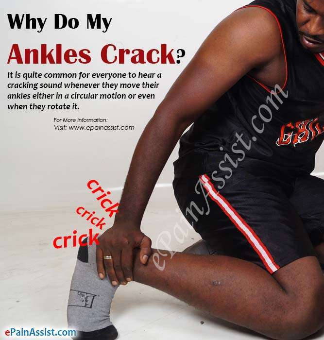 Cracking Ankles: Why Do My Ankles Crack?