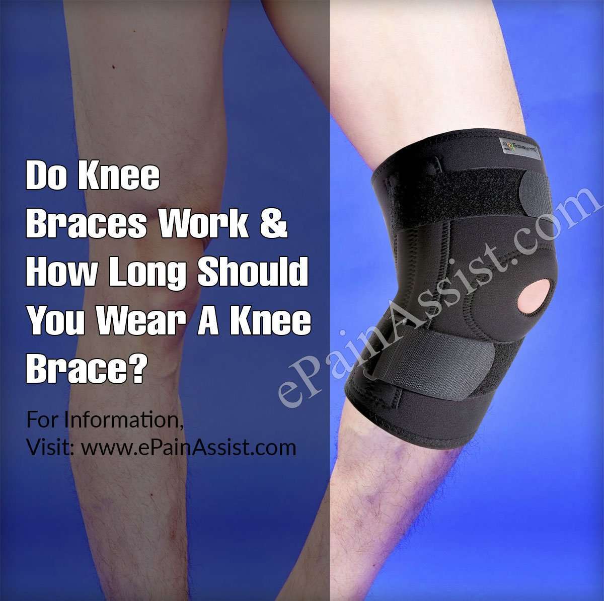 Do Knee Braces Work &  How Long Should You Wear A Knee Brace?