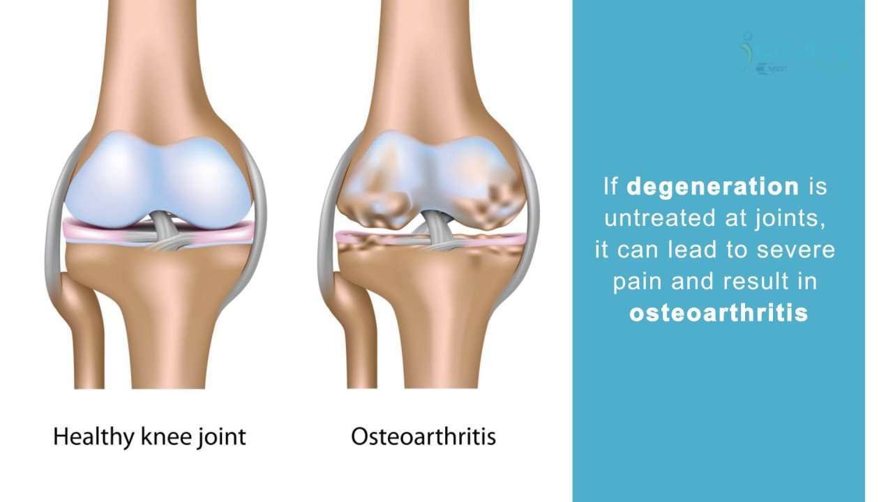 Do you have intense knee pain?