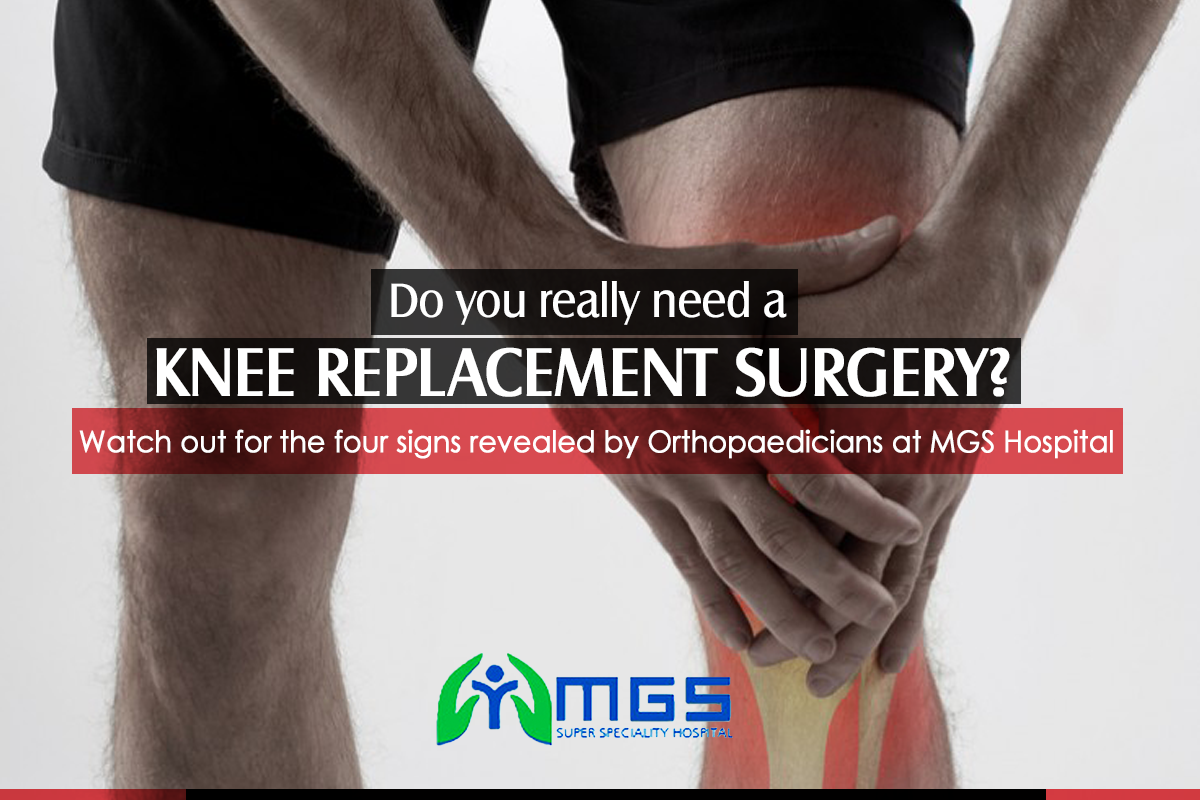 Do you really need a Knee Replacement Surgery? Watch out ...