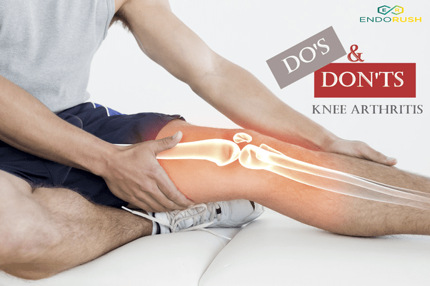 DOâs and Dontâs for Managing Knee Arthritis Pain ...
