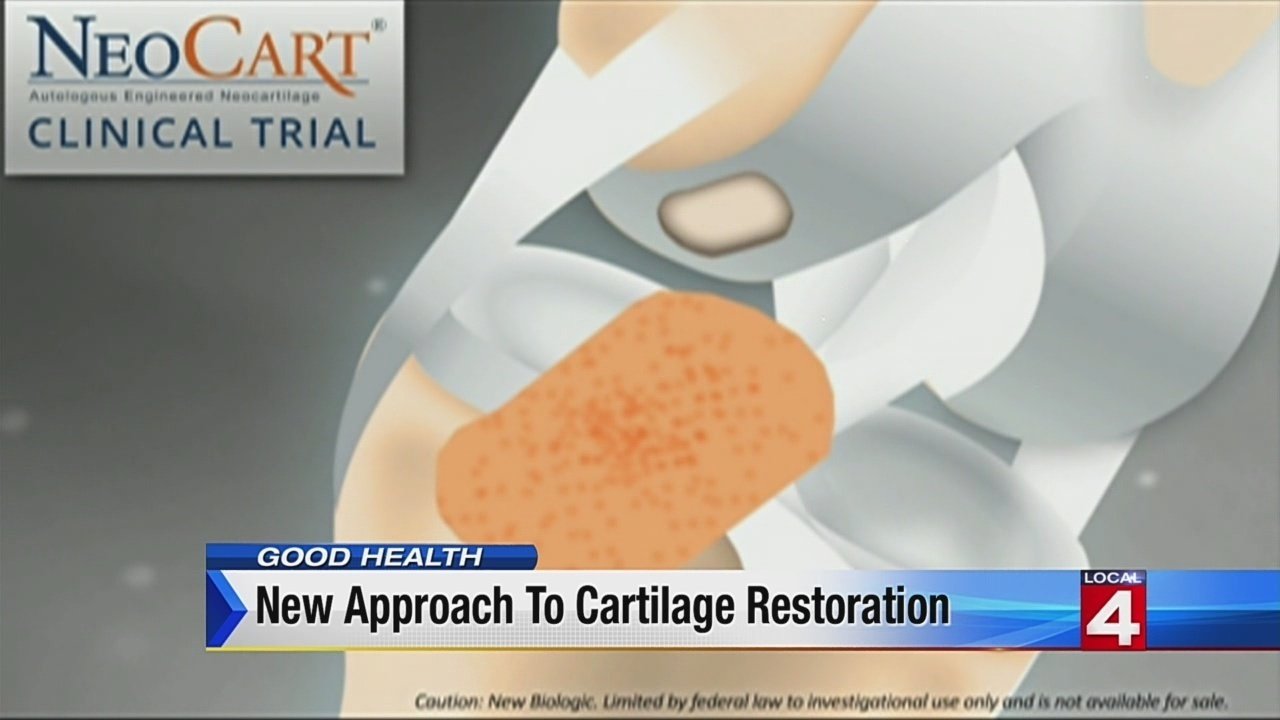 Doctors testing new procedure to rebuild knee cartilage