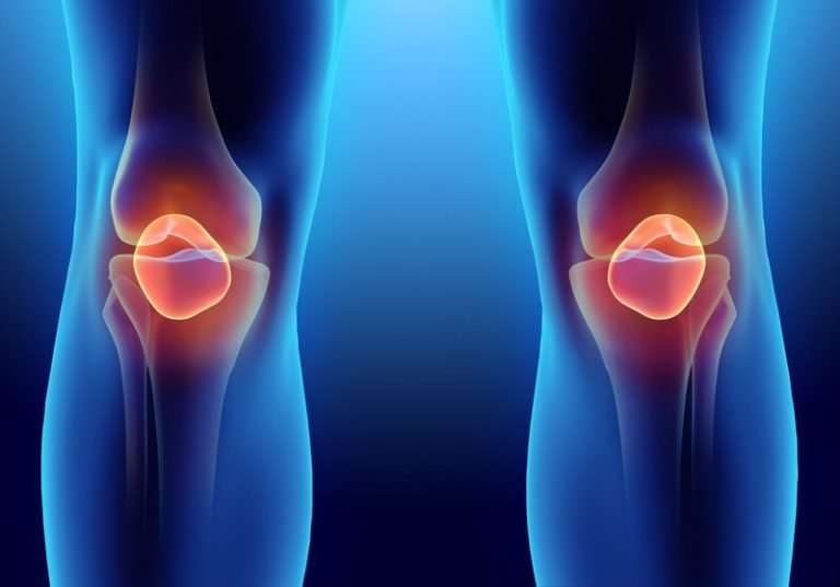 Evaluating the Effectiveness of Arthroscopic Knee Surgery ...