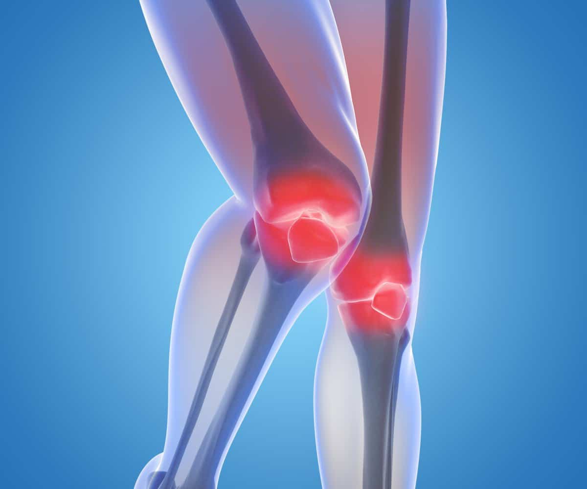 Everyday Health on Twitter: " Knee pain? The best thing you can do for ...