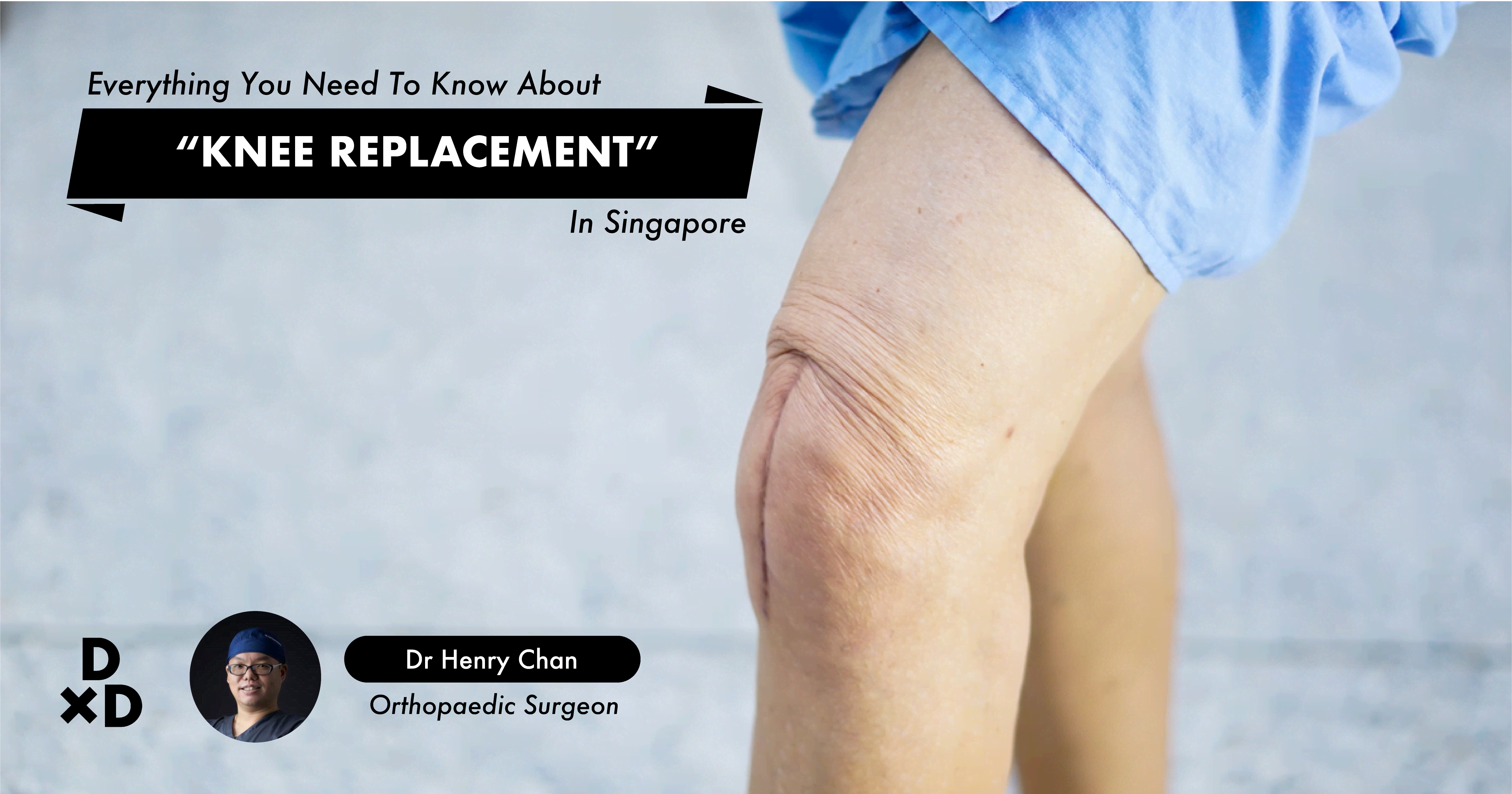 Everything You Need To Know About Knee Replacements In ...