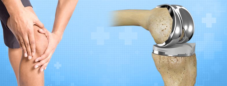 Everything You Need to Know before Having Knee Joint ...