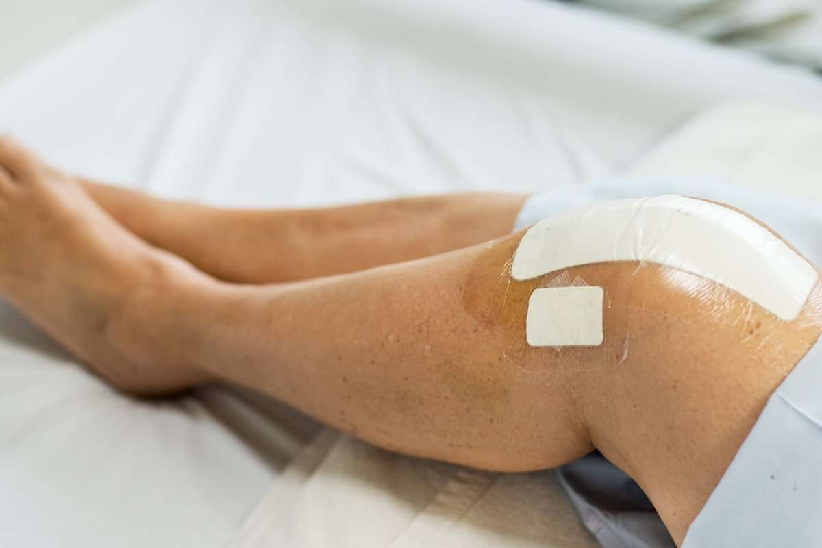 Goodbye to Knee pain with advanced Total Knee Replacement ...