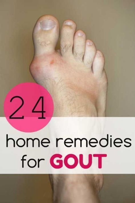 Gout is a type of arthritis that mostly affects joints on ...