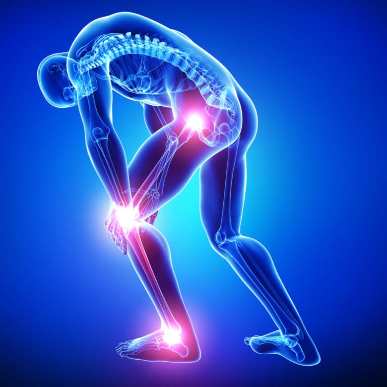 Hip and Knee Osteoarthritis: symptoms, diagnosis and treatment ...