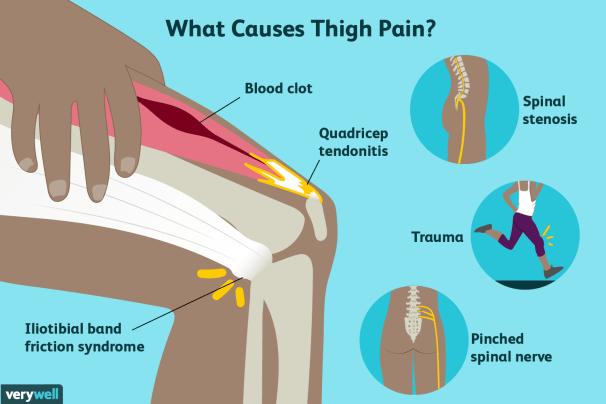 Hip replacement problems that cause thigh pain