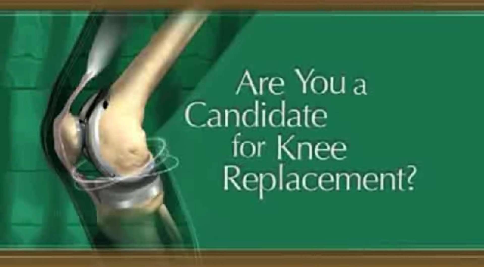 How do I know if I need knee replacement surgery?